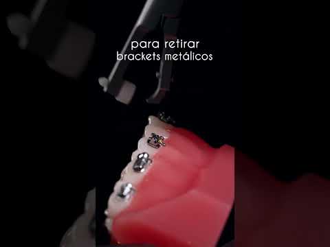 Quitar brackets sin molestias: Conoce los 2 modelos de pinzas quita brackets.