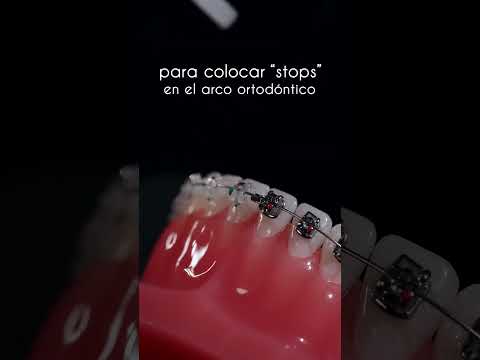 Pinza para crimping, coloca stops con precisión en el arco ortodóntico