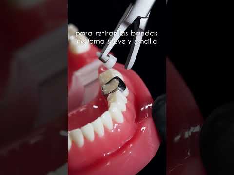 Pinza quita bandas, ejemplo práctico de uso en tipodonto.  