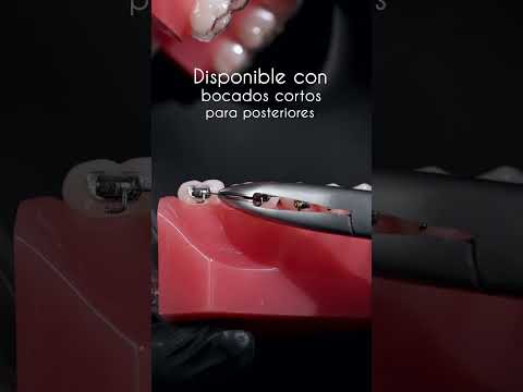 Pinza Weingart, el asistente perfecto para colocar arcos en posteriores.  